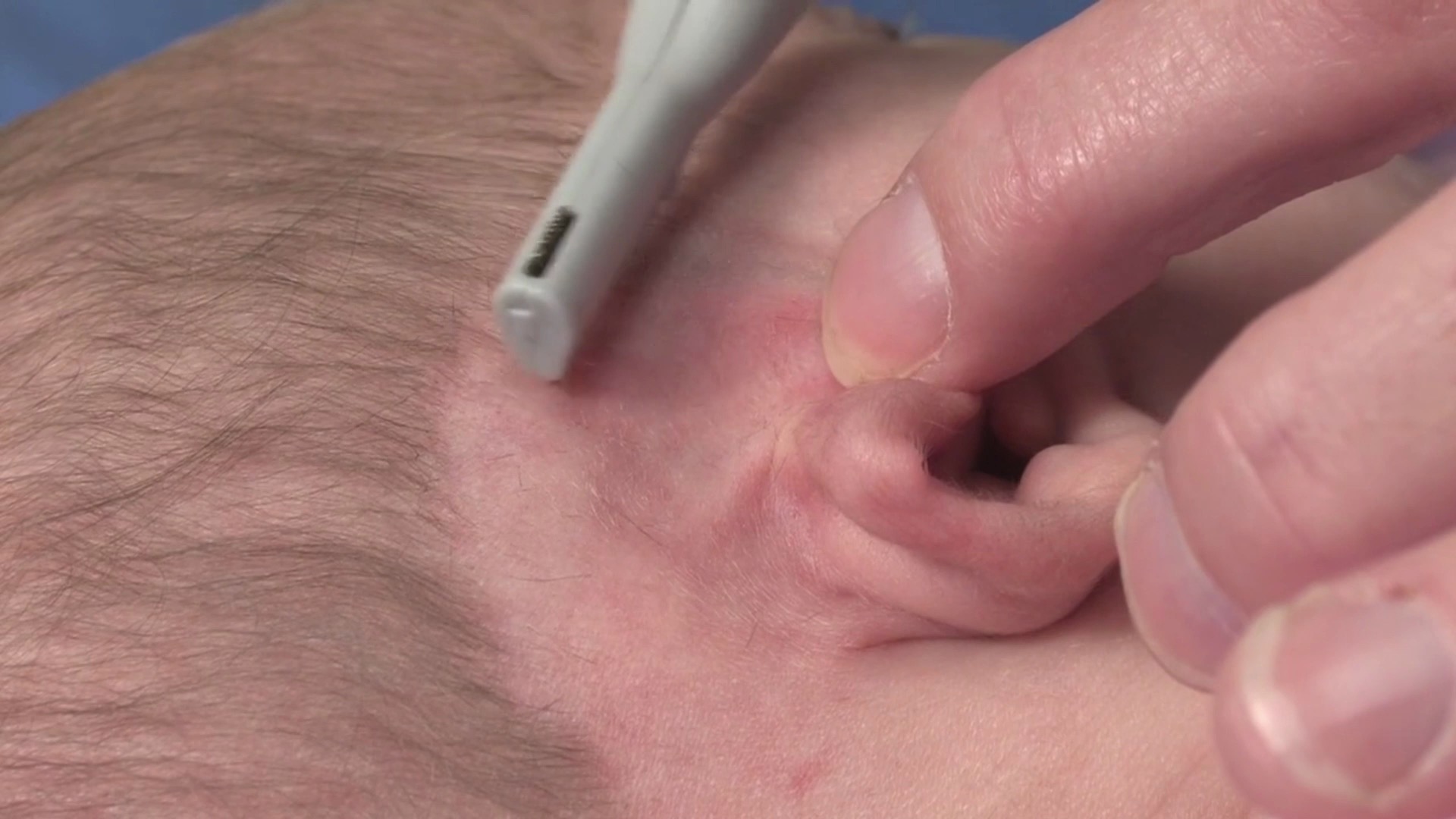 Průběh nasazení systému EarWell